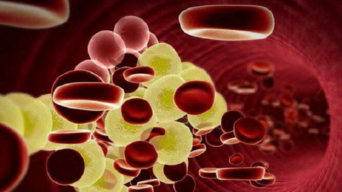 Cảnh báo nguy hiểm do tăng lipid máu